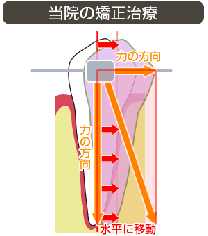 矯正歯科 - 渋谷区の歯科医院 幡ヶ谷わく島歯科